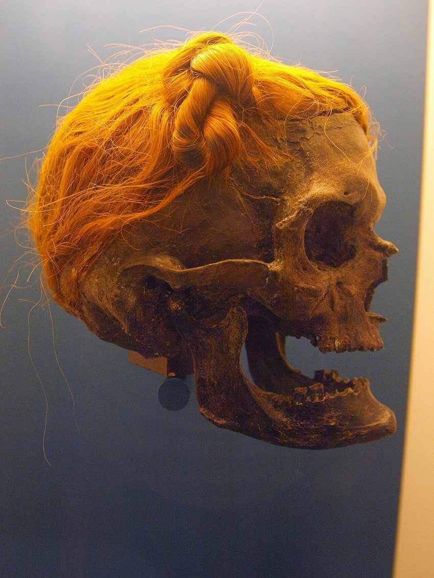 Head of the Man of Osterby with the Suebian knot